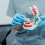 Iată cum trebuie să ai grijă de coroanele dentare